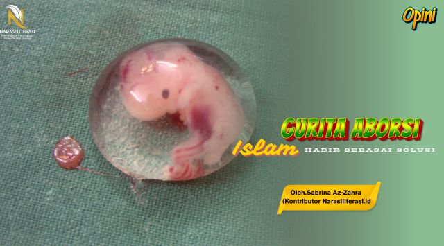 Gurita Aborsi, Islam Hadir sebagai Solusi