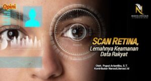 scan retina